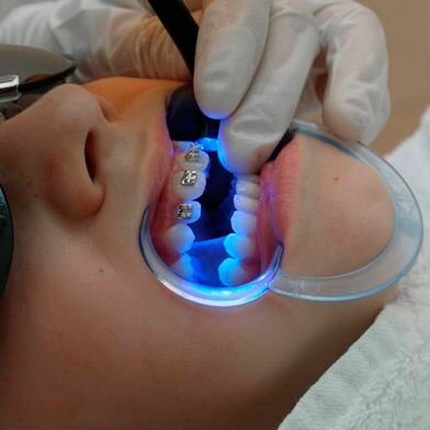 Clínica Dental Dra. Adela Sánchez López niño en odontología
